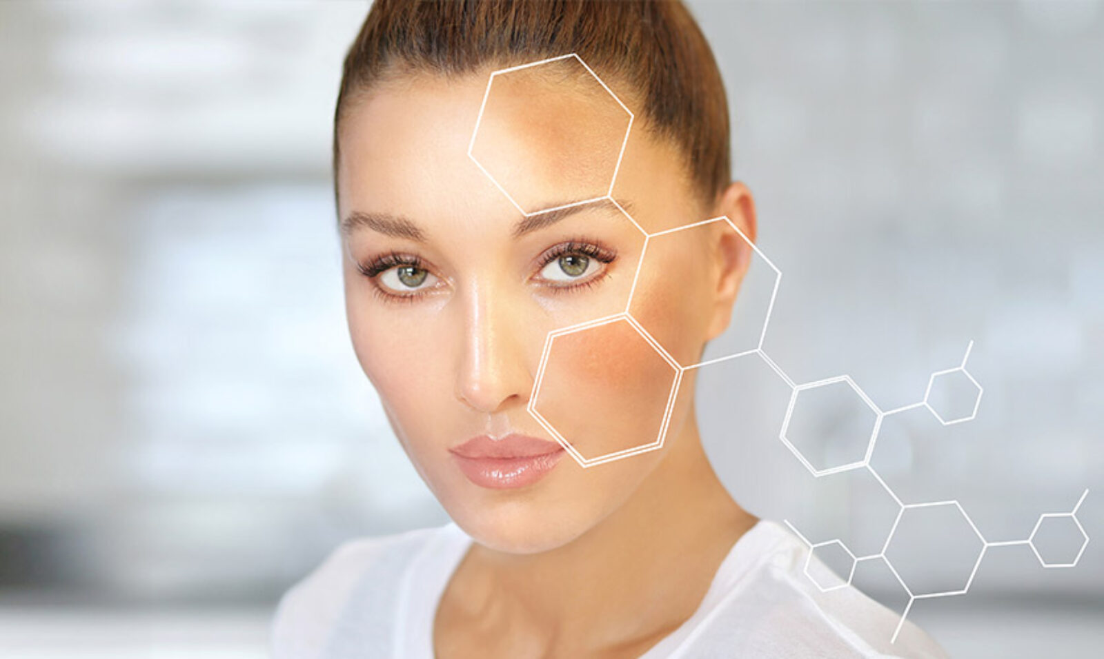 Hiperpigmentasyon Nasıl Geçer?
