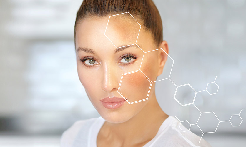 Hiperpigmentasyon Nasıl Geçer?