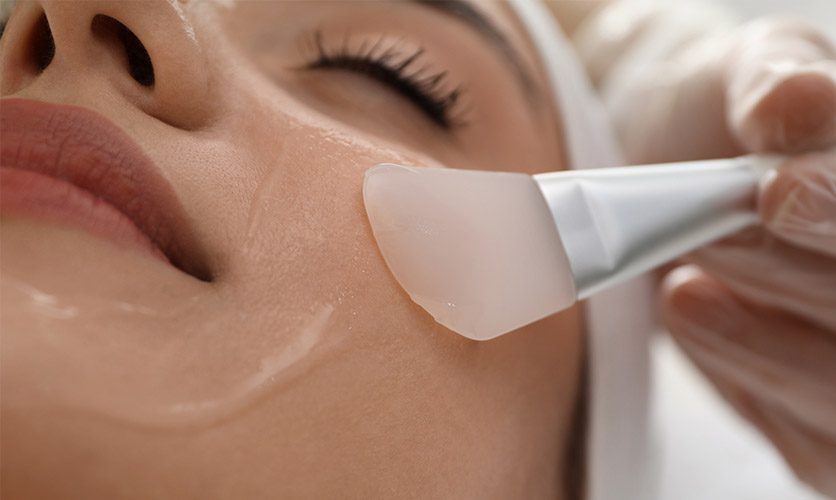 Kimyasal Peeling Nedir?