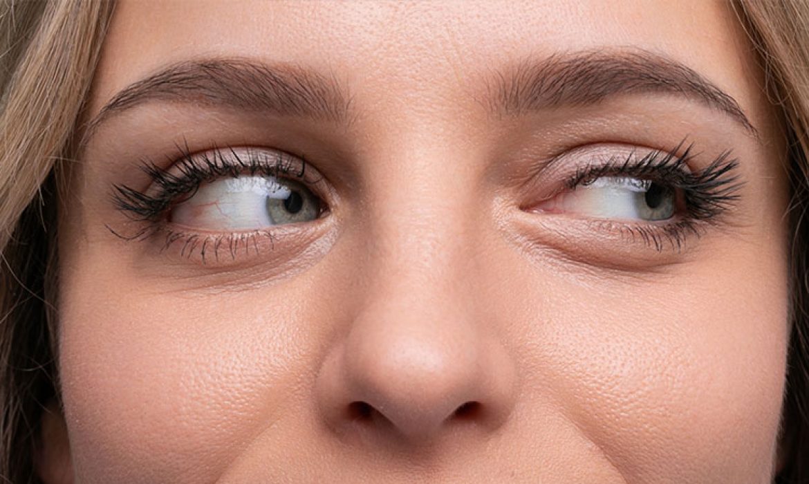 Göz Altı Morluklarına Veda Edin Etkili Tedavi Yöntemleri