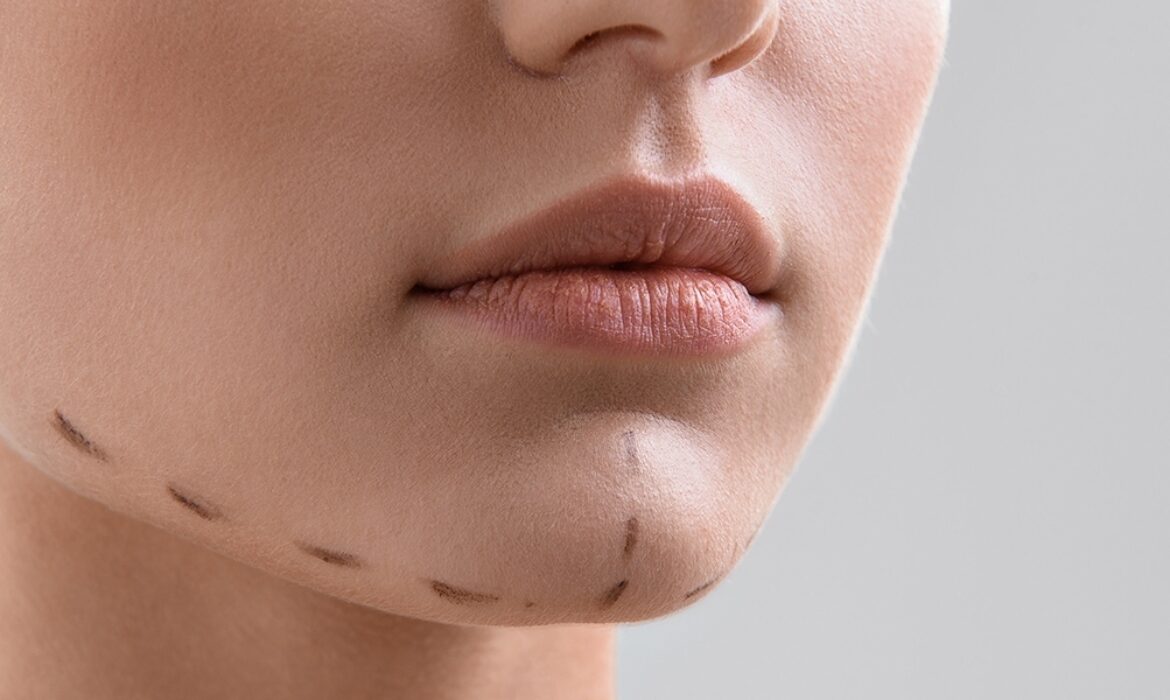 &Ccedil;ene Dolgusu Estetiği Neden Bu Kadar Pop&uuml;ler Oldu?