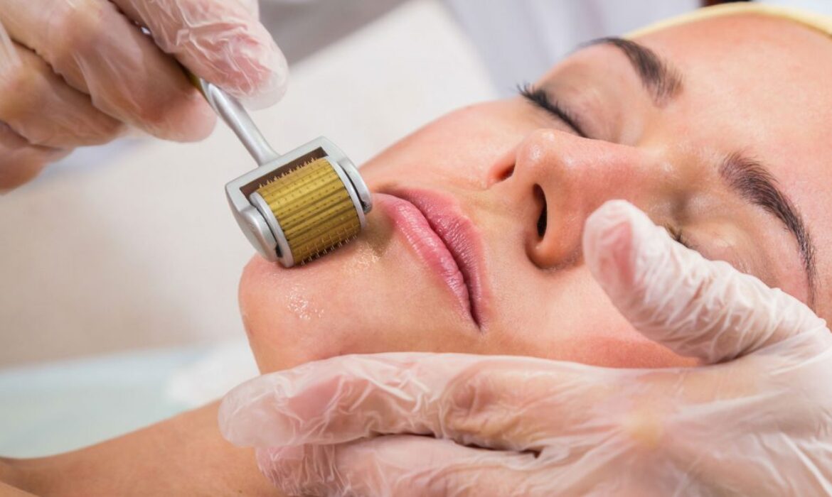 Microneedling (Dermaroller) Tedavisi: Kimler İçin Uygun, Nasıl Etki Eder?