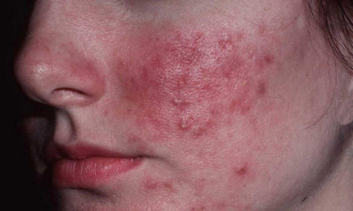 Ciltte Ani Bozulma Neden Olur? 24&ndash;72 Saatte Değişim Yaratan Fakt&ouml;rler