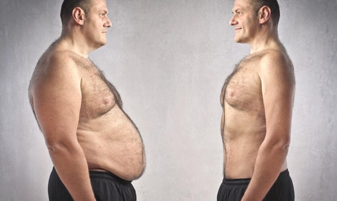 Soğuk Lipoliz ile Göbek Eritme: Ameliyatsız Yağ Azaltmanın Yeni Nesli