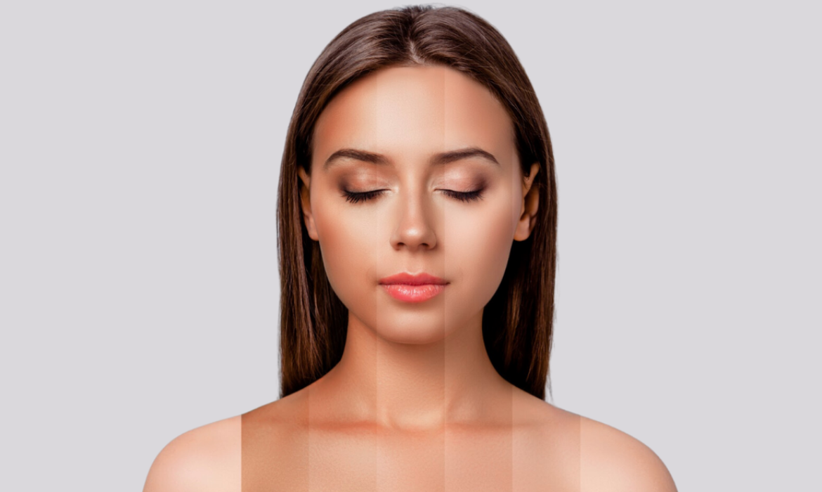 Ciltte Ton Eşitsizliği Neden Olur? Leke Oluşmadan &Ouml;nce M&uuml;dahale