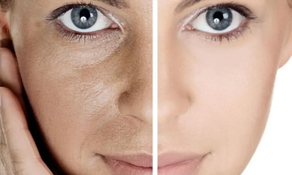 G&ouml;zenek Sıkıştırma Ger&ccedil;ek Mi? Mitler ve Bilimsel Ger&ccedil;ekler