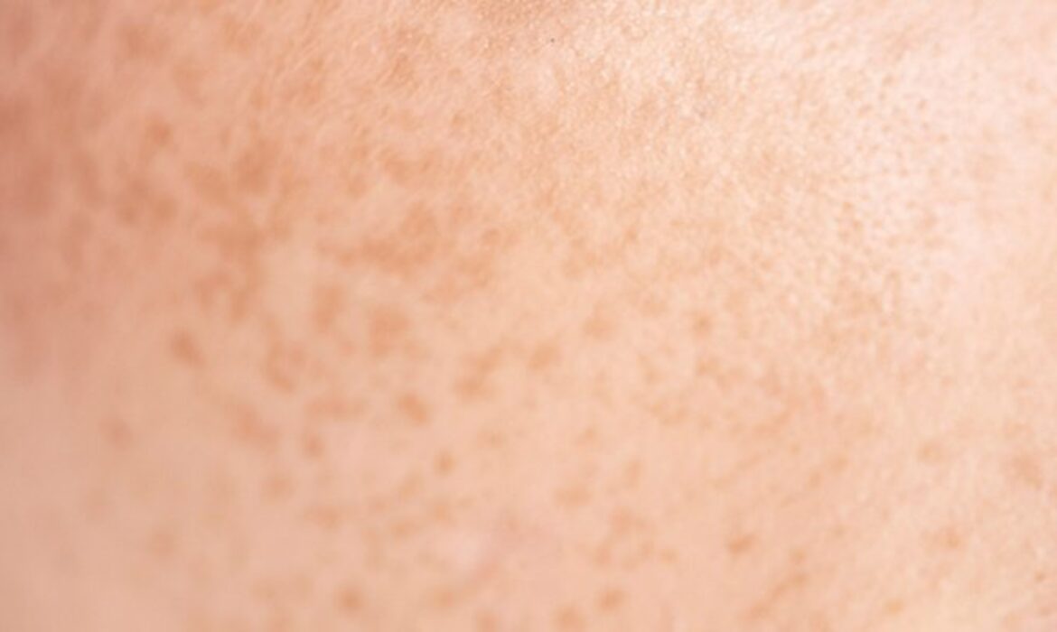 Cilt Neden Bir Anda Hassaslaşır? Bariyer &Ccedil;&ouml;k&uuml;ş&uuml;n&uuml;n Erken Sinyalleri